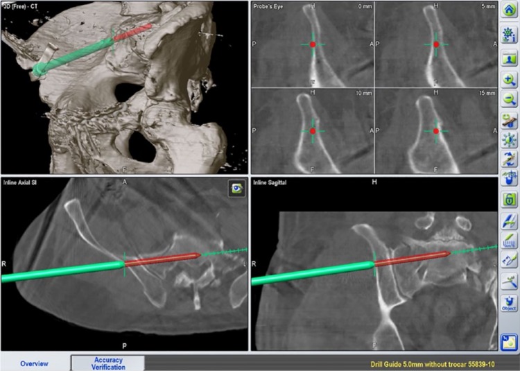 Fig. 10