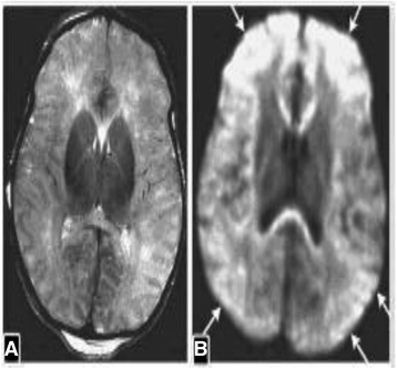 Fig. 14
