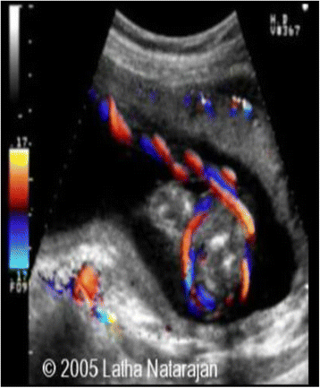 Fig. 12