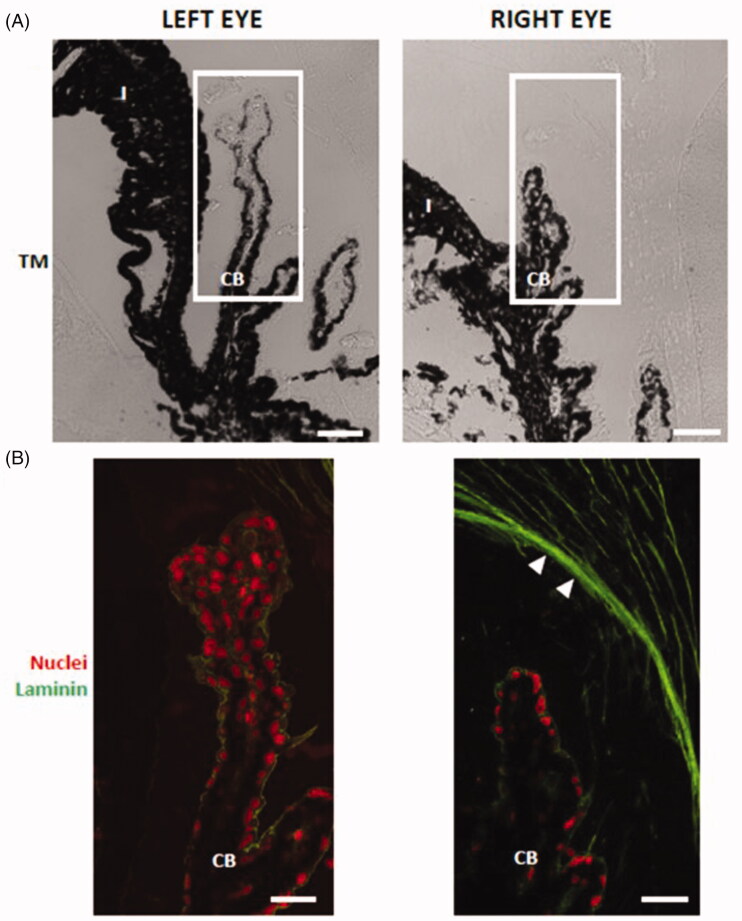 Figure 11.