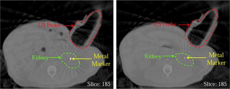 Fig. 12.