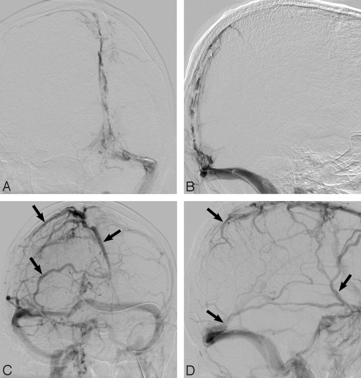 Fig 4.