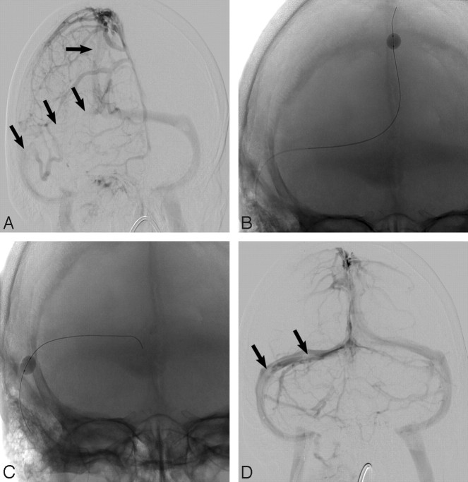 Fig 2.