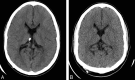 Fig 1.