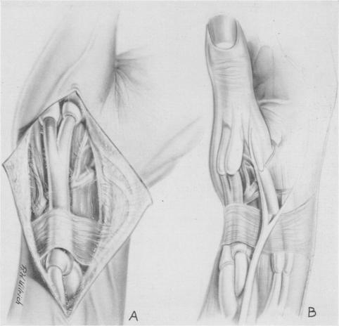 Fig. 3, A and B.