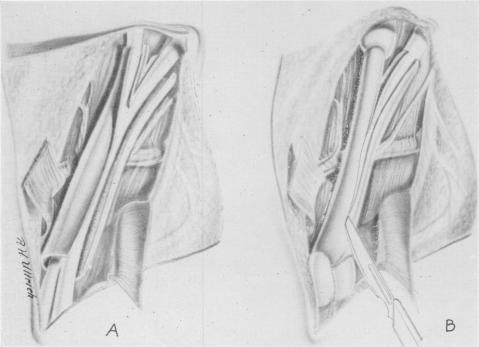 Fig. 4, A and B.