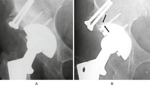 Fig. 13