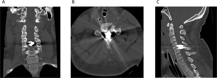 Fig. 2