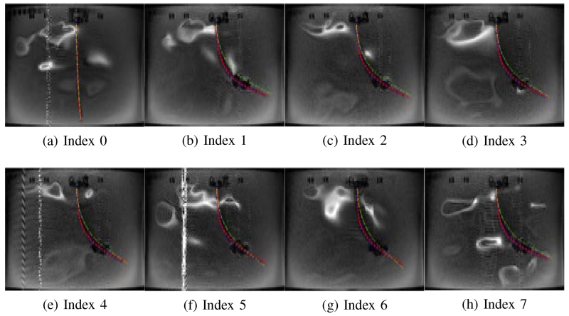 Fig. 16