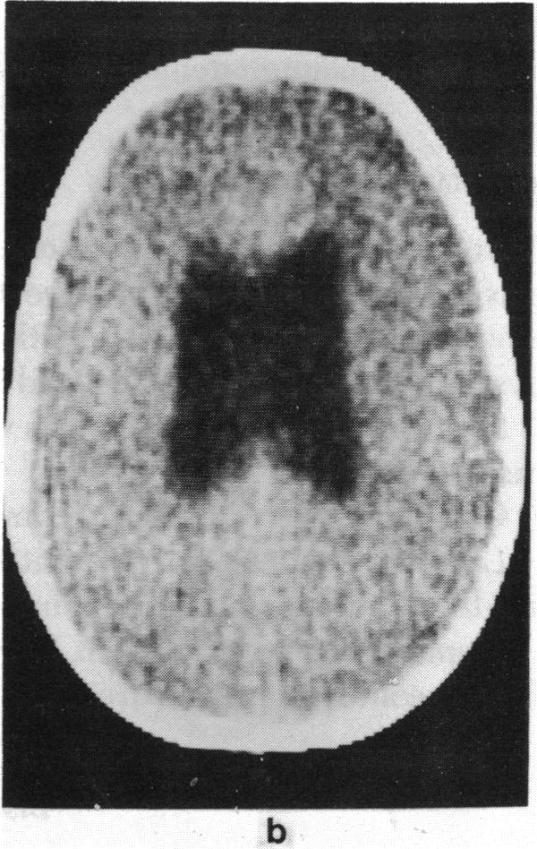 FIGURE 3 b