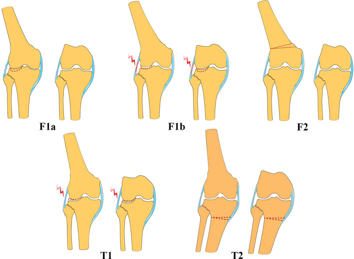 Fig 4