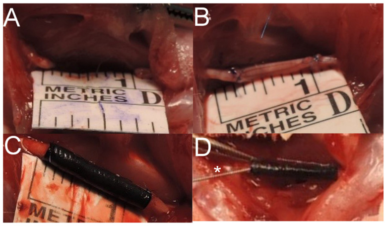 Figure 13