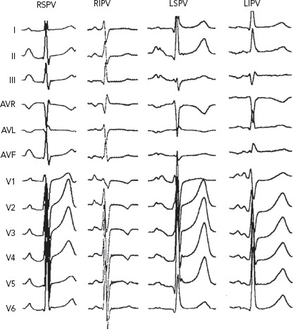 Figure 2: