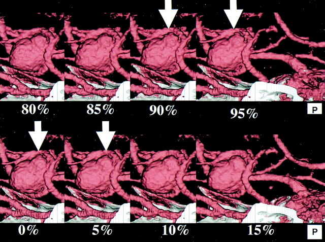 Fig 3.