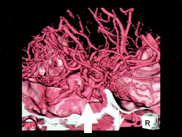 Fig 5.