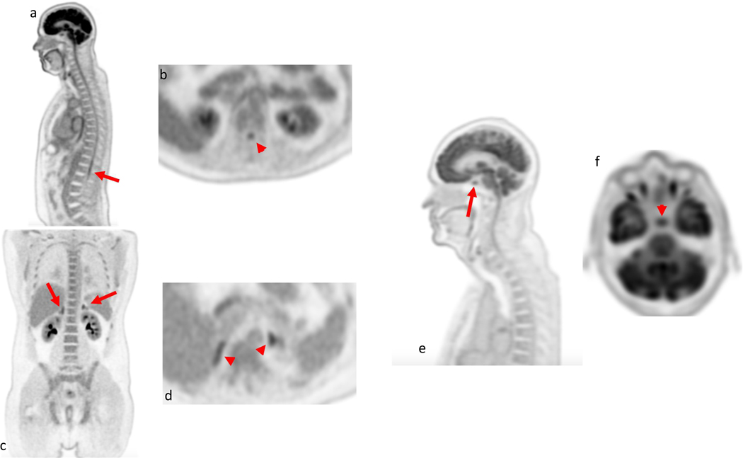 Figure 3: