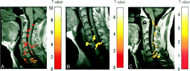 fig 3.