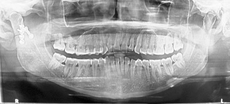 Fig. 6
