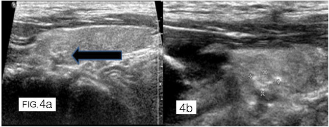 [Table/Fig-4a,b]: