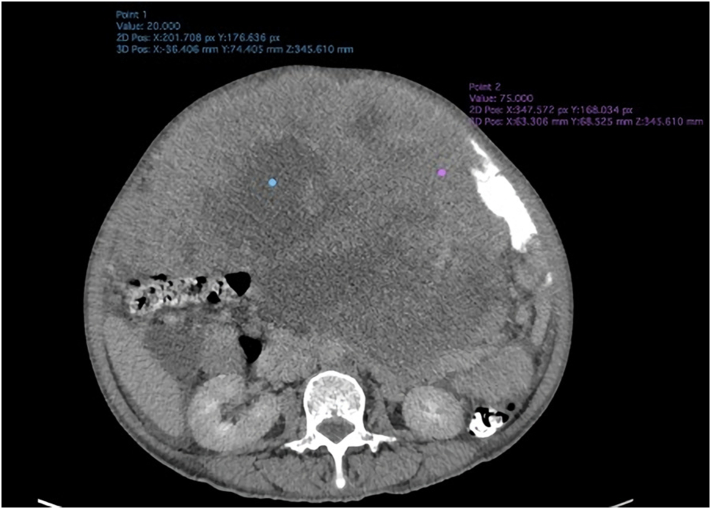 Fig. 2