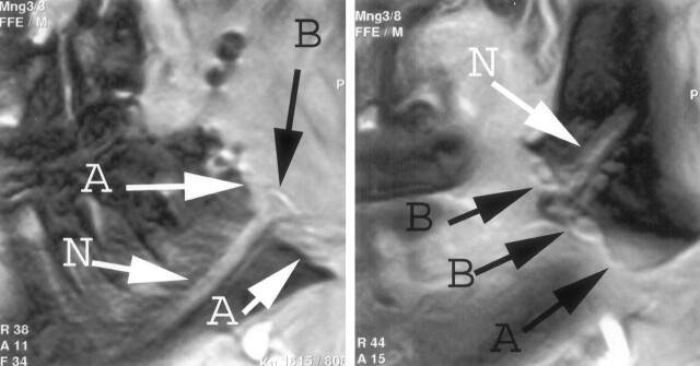 Fig 2.