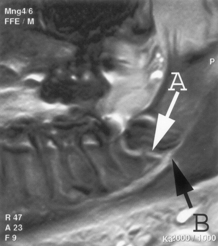 Fig 3.