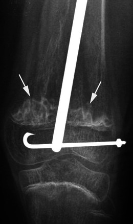 Fig. 19