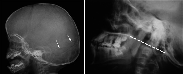 Fig. 12