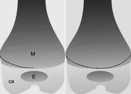 Fig. 24