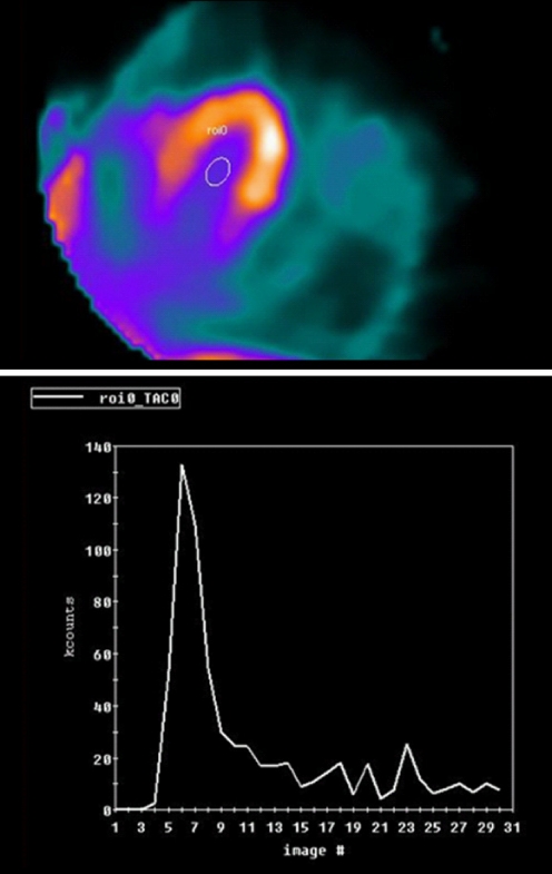 Fig. 11