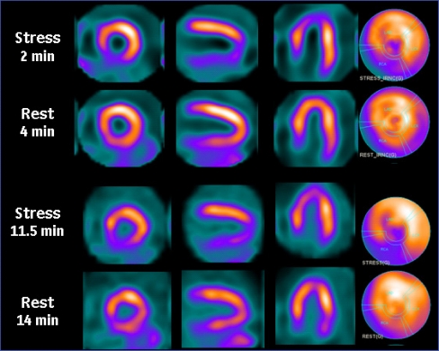 Fig. 12