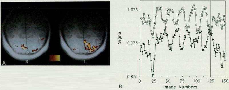 Figs. 3A and 3B