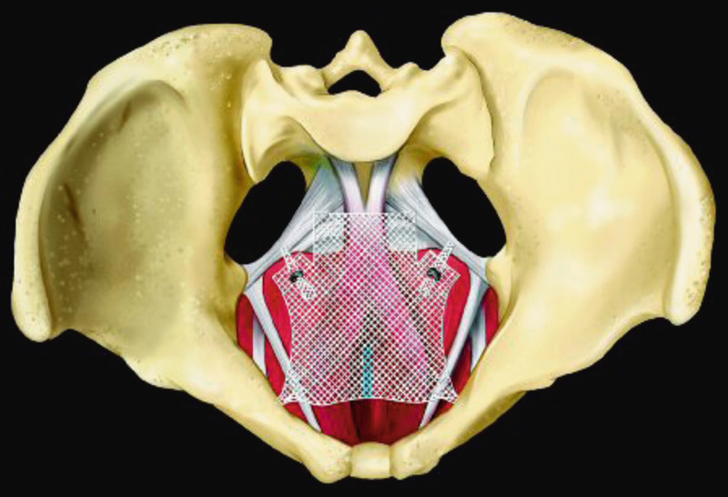 Fig. 4Abb. 4