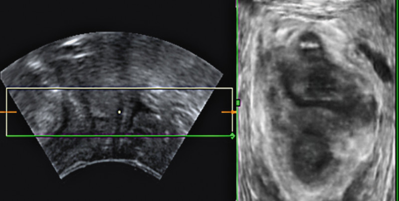 Fig. 3Abb. 3