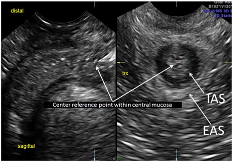 Fig. 3