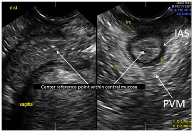 Fig. 2