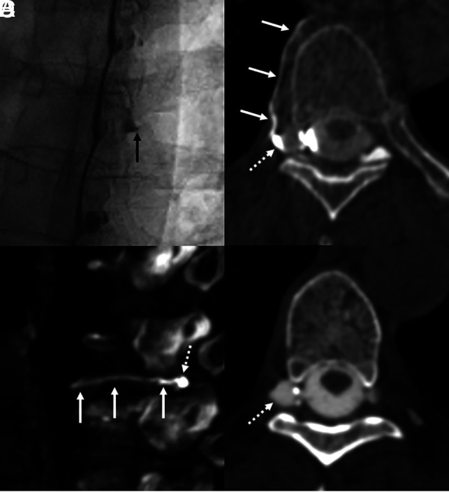 FIG 2.