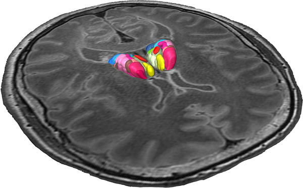 Fig. 3