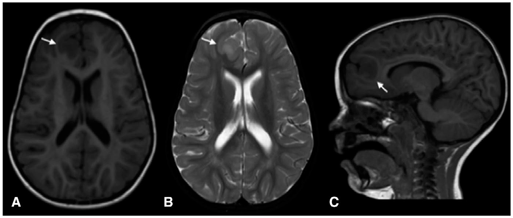 FIGURE 1