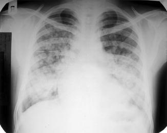 Fig. 1.1