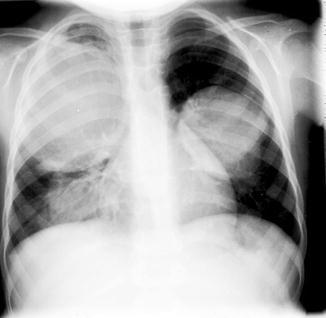 Fig. 1.2