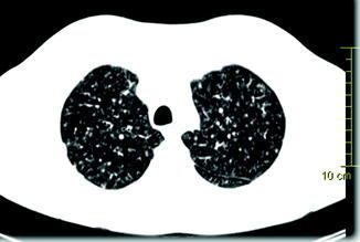 Fig. 1.3