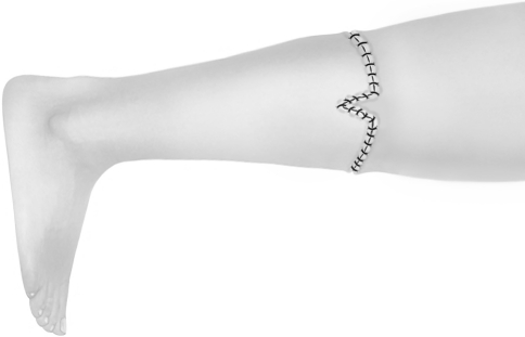 Fig. 3