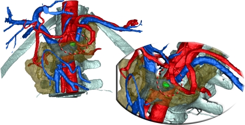 Fig. 4