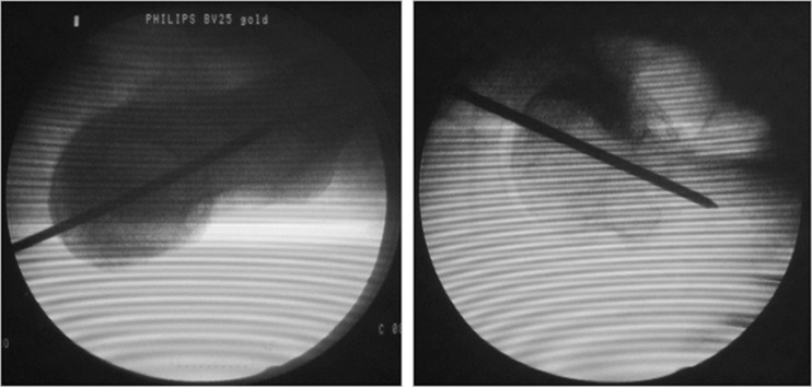 Fig. 5