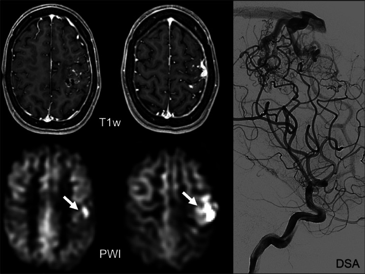 Fig. 9