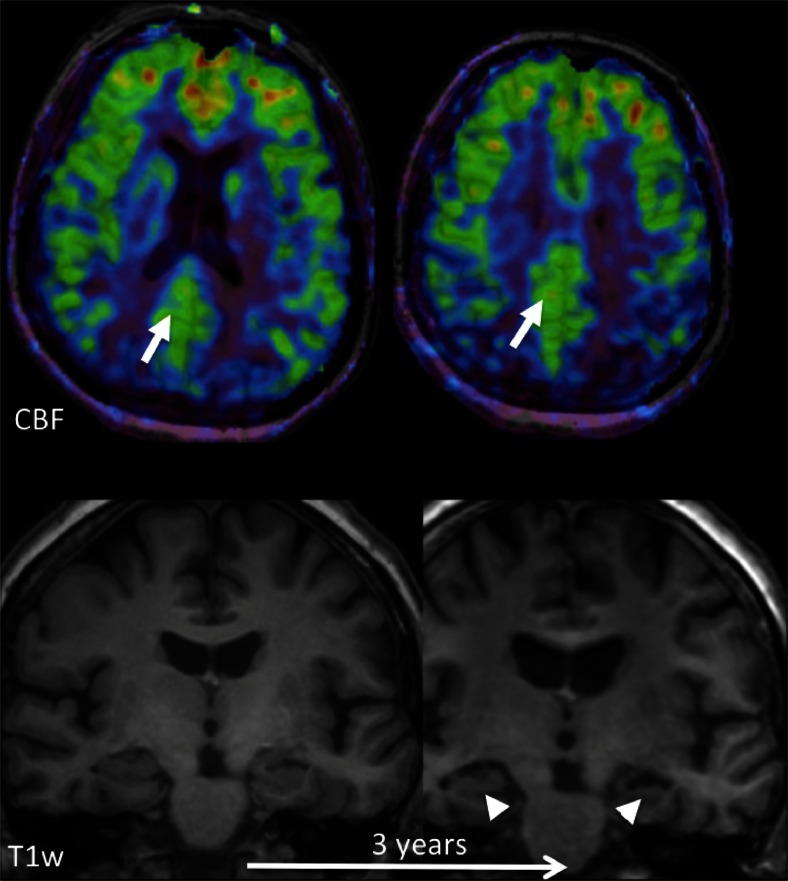 Fig. 11