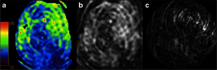 Fig. 12