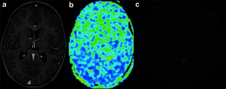 Fig. 13