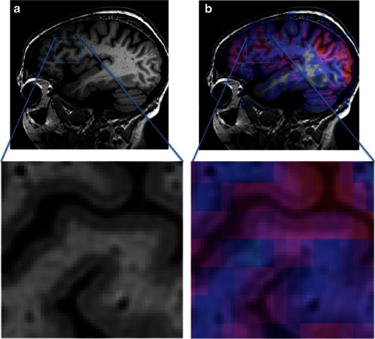 Fig. 14